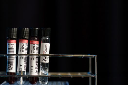 Coronavirus testing process, tube of blood test samples and swab collection kit of coronavirus (COVID-19).