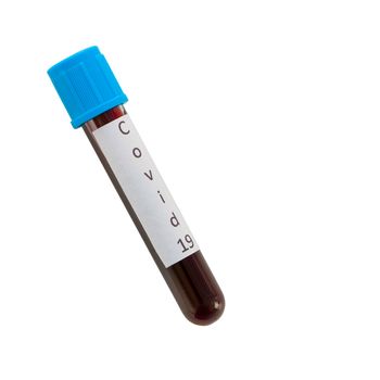 Blood collection tubes from covid 19 patients on a white laboratory table. (Clipping Path include).