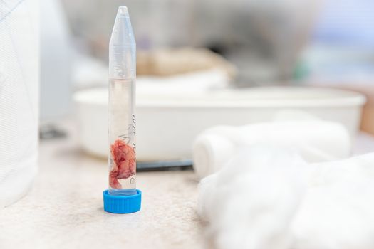 a tissue sample from the tumor to be sent for histological expertise.