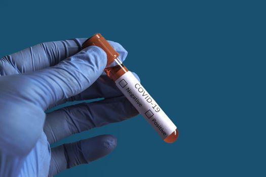 Blood sample tube positive with COVID-19 virus or novel coronavirus 2019 found in Wuhan, China