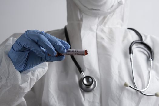 Corona Virus Concept. Doctor Demostrating Test-Tube, holds tube containing a patient’s blood sample at laboratory. COVID-19. Conduct laboratory testing - Positive result. 2019-nCoV virus.