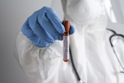 Corona Virus Concept. Doctor Demostrating Test-Tube, holds tube containing a patient’s blood sample at laboratory. COVID-19. Conduct laboratory testing - Positive result. 2019-nCoV virus.