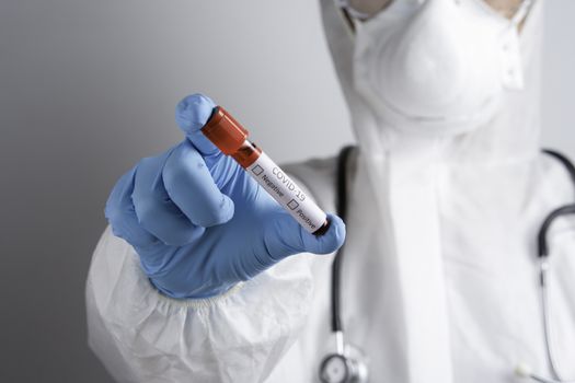 Corona Virus Concept. Doctor Demostrating Test-Tube, holds tube containing a patient’s blood sample at laboratory. COVID-19. Conduct laboratory testing - Positive result. 2019-nCoV virus.