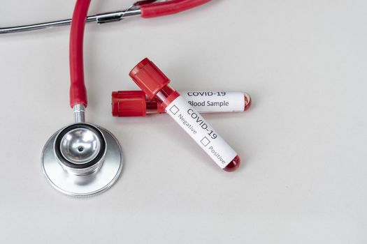 Stethoscope and blood sample vacuum tube. Covid-19 or Coronavirus Concept, Biological blood samples in test tubes and vaccine for the disease and syringe injection on a table. Laboratory test.