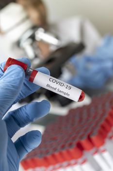 Cropped view of scientist in latex glove holding test tube with blood sample, Test tube with blood sample for COVID-19 test, novel coronavirus 2019.