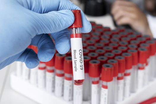 Cropped view of scientist in latex glove holding test tube with blood sample, Test tube with blood sample for COVID-19 test, novel coronavirus 2019.