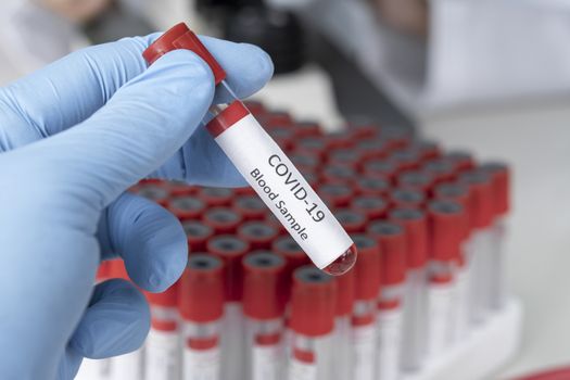 Cropped view of scientist in latex glove holding test tube with blood sample, Test tube with blood sample for COVID-19 test, novel coronavirus 2019.