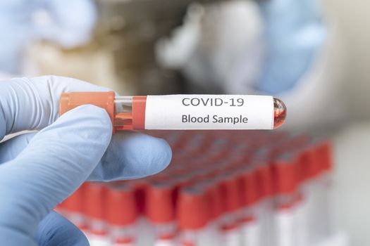 Cropped view of scientist in latex glove holding test tube with blood sample, Test tube with blood sample for COVID-19 test, novel coronavirus 2019.