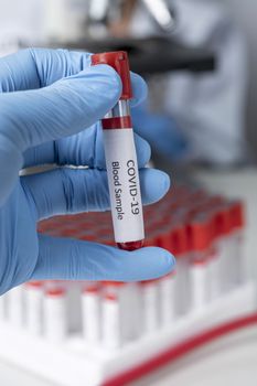 Cropped view of scientist in latex glove holding test tube with blood sample, Test tube with blood sample for COVID-19 test, novel coronavirus 2019.