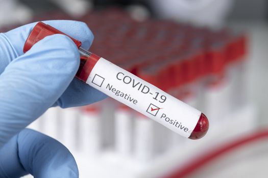 Cropped view of scientist in latex glove holding test tube with blood sample, Test tube with blood sample for COVID-19 test, novel coronavirus 2019.