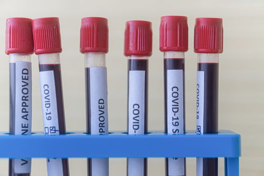 test tube with blood for 2019-nCoV analyzing. Novel  covid19 blood test Concept.