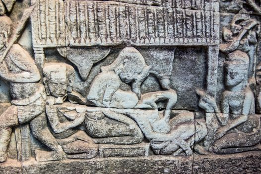An ancient Khmer bas relief carving showing a woman giving birth. Wall of Bayon Temple, Angkor Thom, Siem Reap, Cambodia.