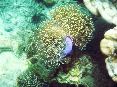 The Sea Anemones under the sea are invertebrates.