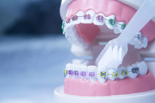 Model denture with metal orthodontics. No people