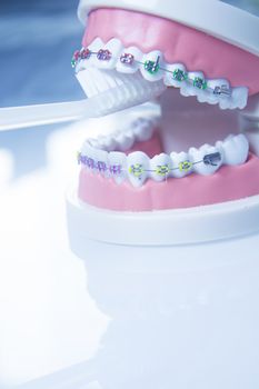 Model denture with metal orthodontics. No people