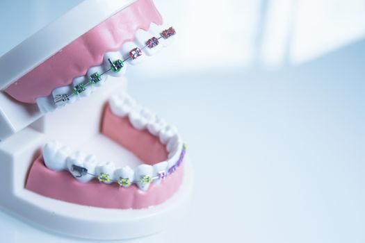 Model denture with metal orthodontics. No people