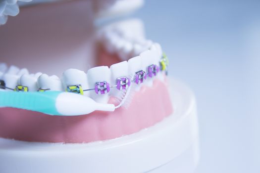 Model denture with metal orthodontics. No people