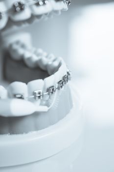 Model denture with metal orthodontics. No people