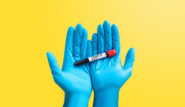 closeup hand in blue rubber glove holding Coronavirus blood sample in test tube for covid-19 analyzing, isolated on yellow. laboratory analyzing for testing and invent drug and vaccine for Coronavirus
