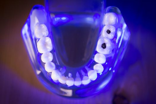 Denture for dentistry students with different health problems