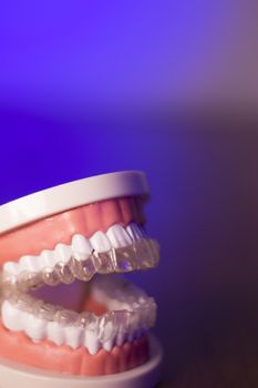 Denture for dentistry students with transparent orthodontics