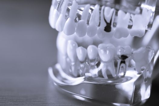 Denture for dentistry students with different health problems