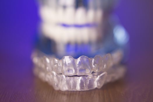 Transparent dental orthodontics for adults and children