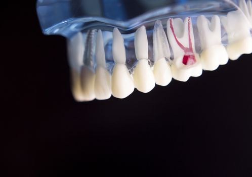 Denture for dentistry students with different health problems