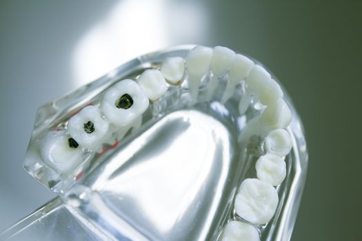 False teeth sample for dentists