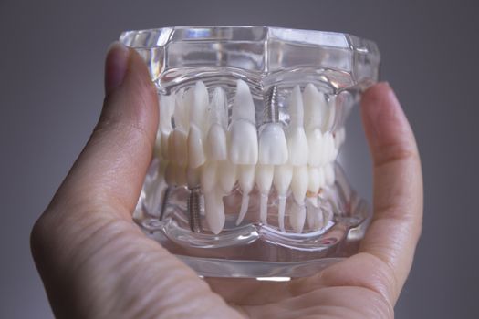 False teeth gripped by the hand of a woman

