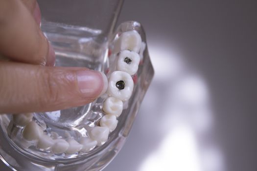 False teeth gripped by the hand of a woman
