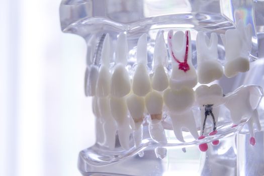 False teeth sample for dentists