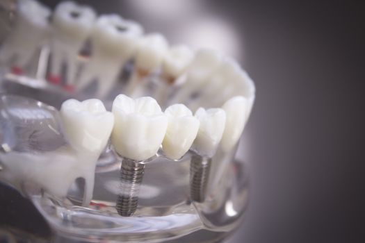 False teeth sample for dentists
