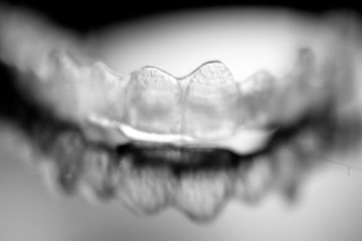Dental aligner. Invisible dental orthodontics