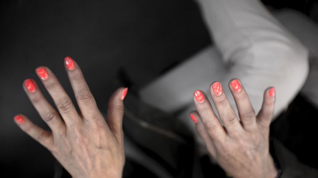 Hands of a middle aged woman with problems of rheumatism, osteoarthritis and skin blemishes