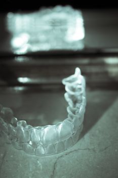 Invisible orthodontics to align the teeth