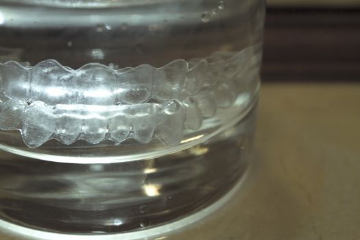 Invisible orthodontics to align the teeth