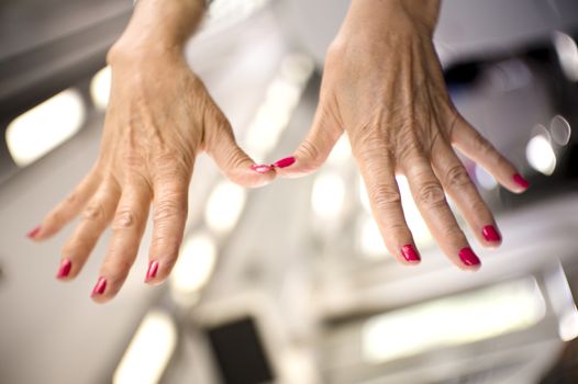 Hands of a middle aged woman with problems of rheumatism, osteoarthritis and skin blemishes