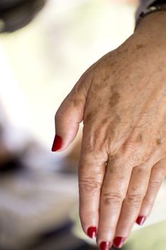 Hands of a middle aged woman with problems of rheumatism, osteoarthritis and skin blemishes
