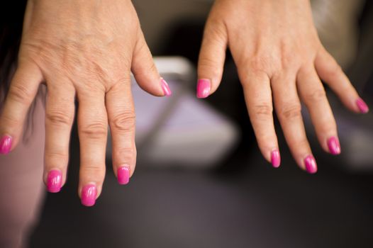 Hands of a middle aged woman with problems of rheumatism, osteoarthritis and skin blemishes