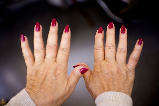 Hands of a middle aged woman with problems of rheumatism, osteoarthritis and skin blemishes