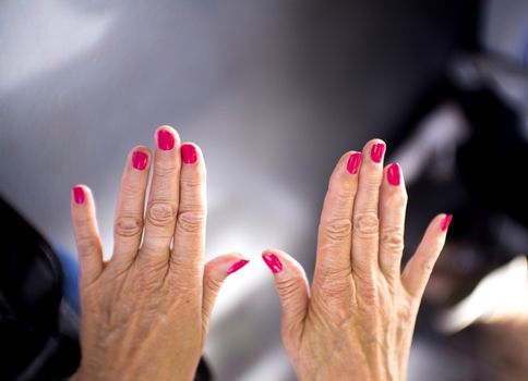 Hands of a middle aged woman with problems of rheumatism, osteoarthritis and skin blemishes