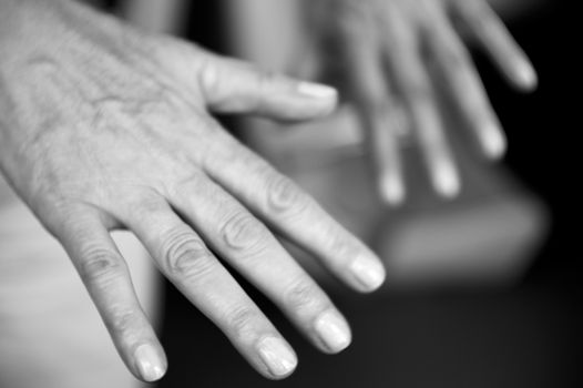 Hands of a middle aged woman with problems of rheumatism, osteoarthritis and skin blemishes
