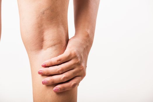 Closeup young Asian woman painful varicose and spider veins on leg, studio shot isolated on white background, Healthcare medical and hygiene skin body varicose veins problems care concept