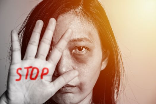 stop violence against women campaign. Asia woman with bruise on arms and face raised her hand for dissuade, hand write the word STOP in red color.