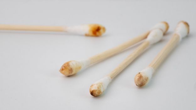 Cotton buds contaminated with earwax on white background. Body cleaning and Health care concept.