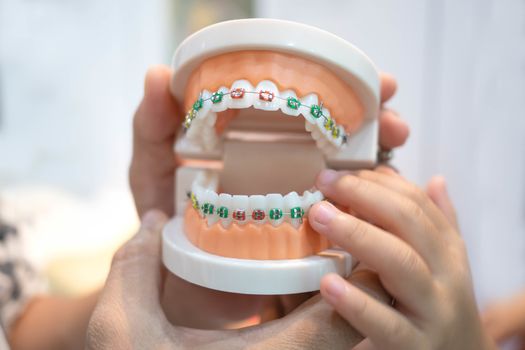 The dentist is holding dentures in hands and shows how the system of braces on teeth is arranged. Prosthetic dentistry concept.