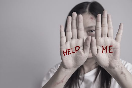 stop violence against women campaign. Asia woman with bruise on arms and face raised her hand for dissuade, hand write the word help me.