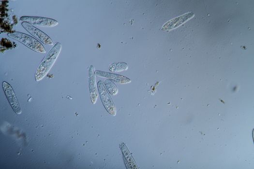 Plankton with microscopic ciliates