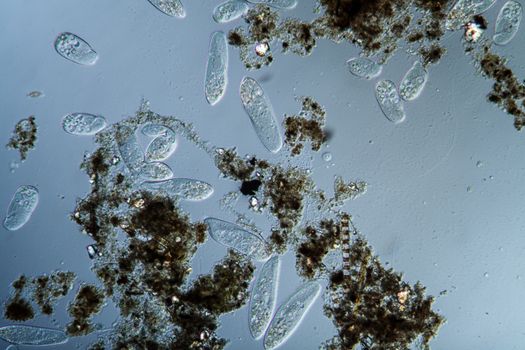 Plankton with microscopic ciliates